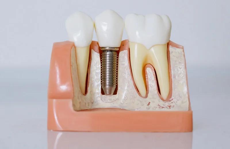 Pediatric dentistry